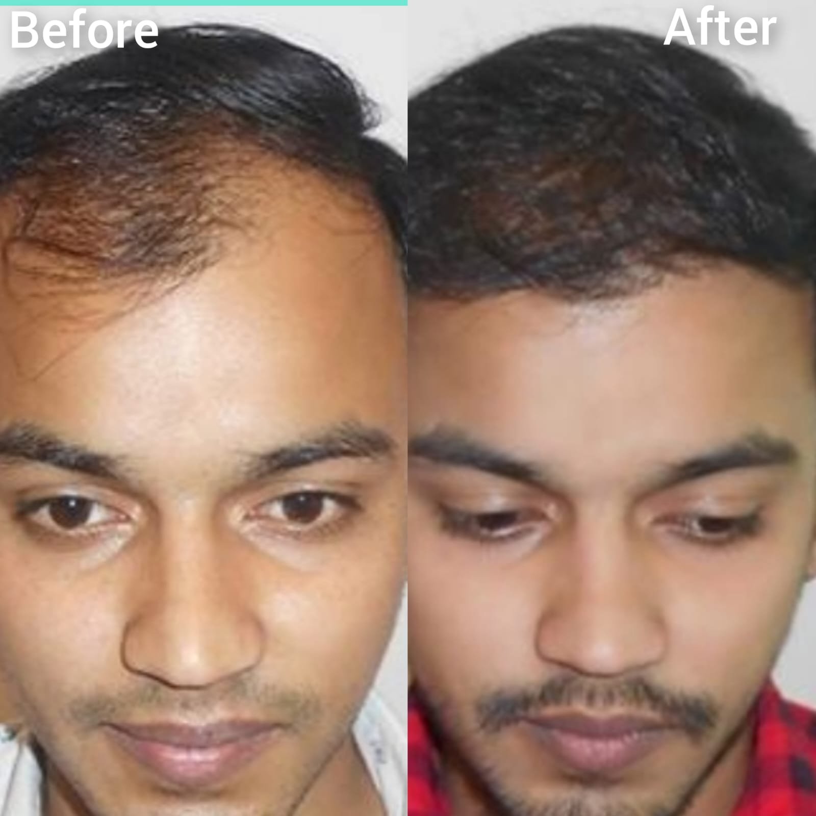 Home nexaherbals Nexa herbal pure ayurvedic medicines..